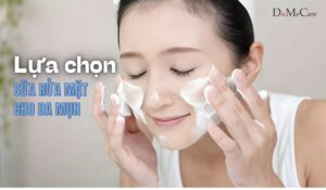 Tieu chi lua chon sua rua mat cho da mun