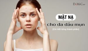 Lua chon mat na cho da dau mun