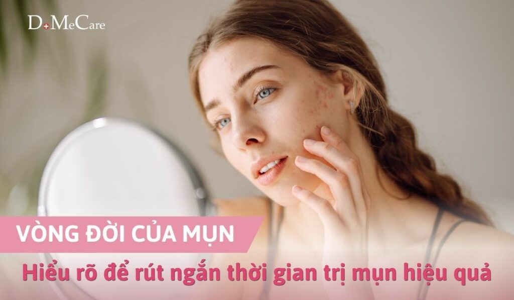Vòng đời của mụn