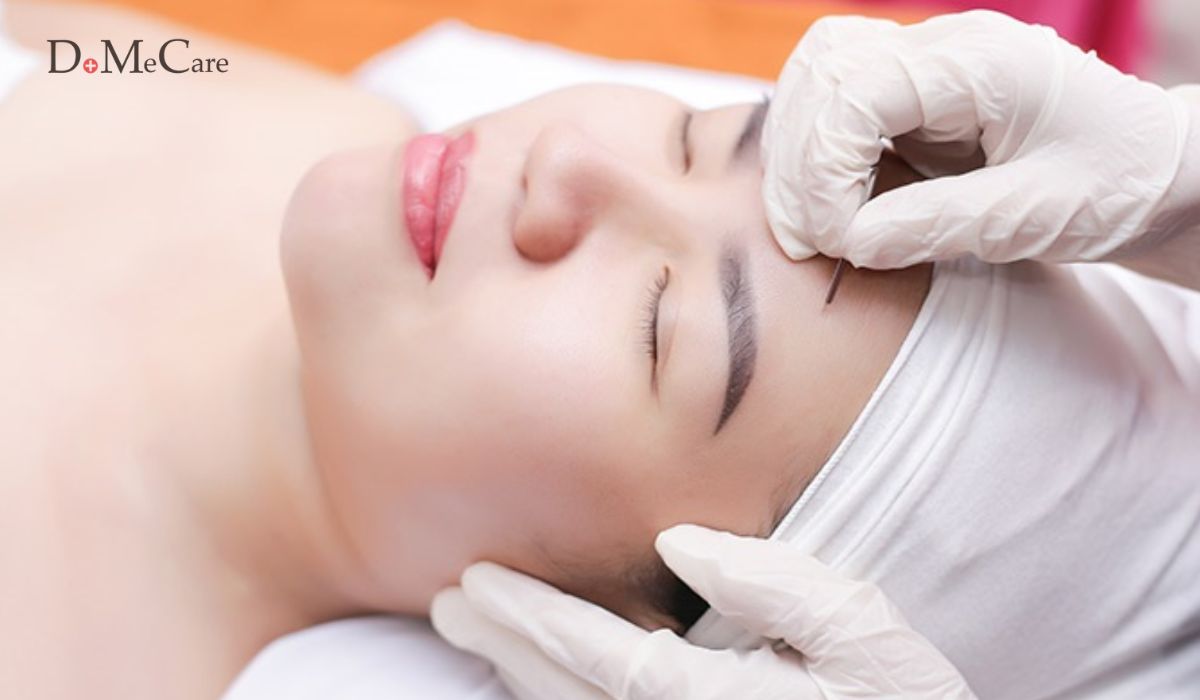 Vòng đời của mụn